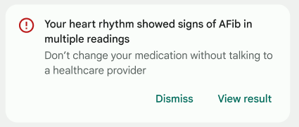 Irregular rhythm notification in the Fitbit app